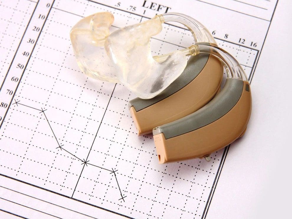 A pair of hearing aids sitting on top of a paper.